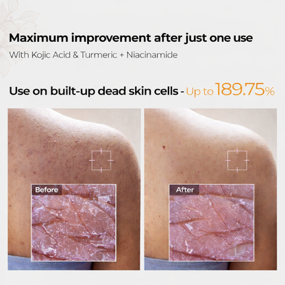 Turmeric Kojic Acid Exfoliating Spray